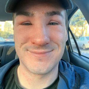 Hiking to blow off steam, but an allergic reaction ruins the day.